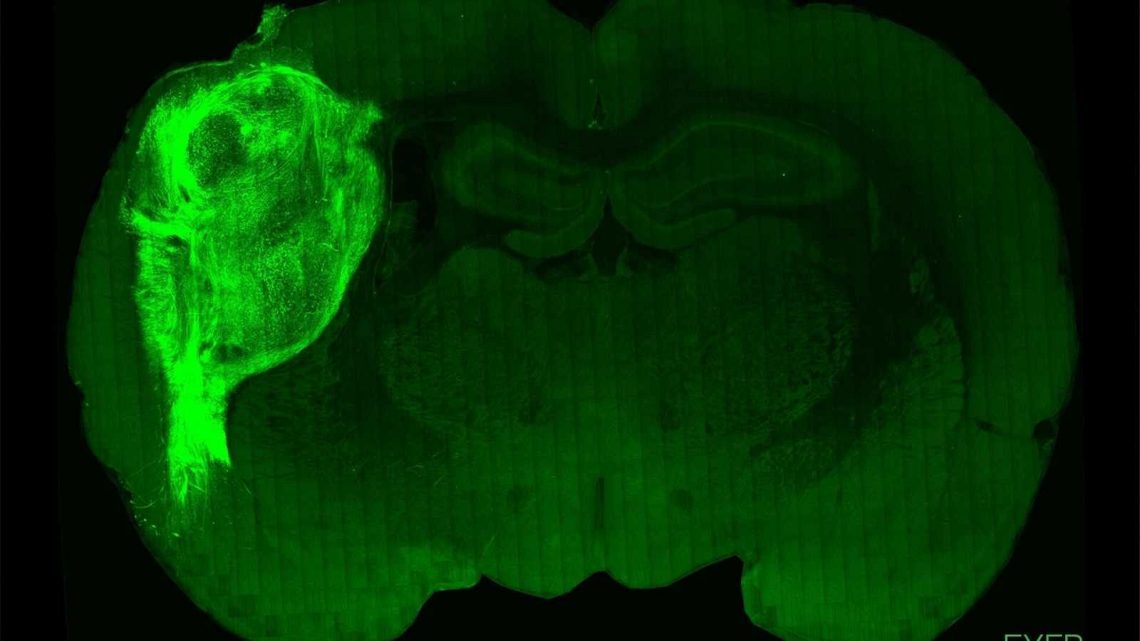 Implantan 'minicerebros' humanos en ratas recién nacidas