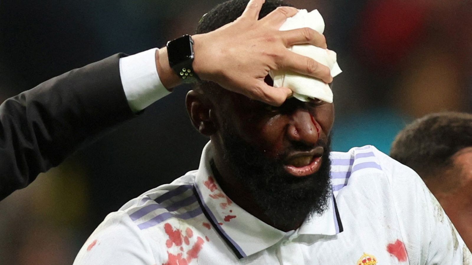 Rudiger y Courtois, dudas para el Clásico | Ver