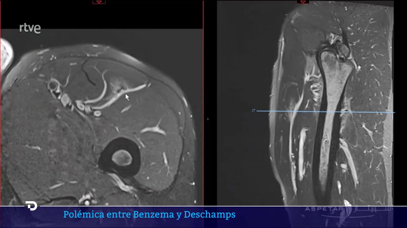 El agente de Benzema dice que podía haber jugado en octavos | Ver