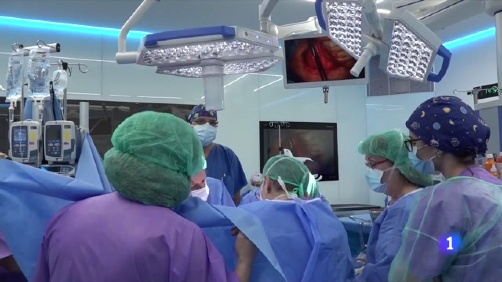 Catalunya supera el màxim històric de trasplantaments que es va aconseguir abans de la pandèmia - L'Informatiu | Ver