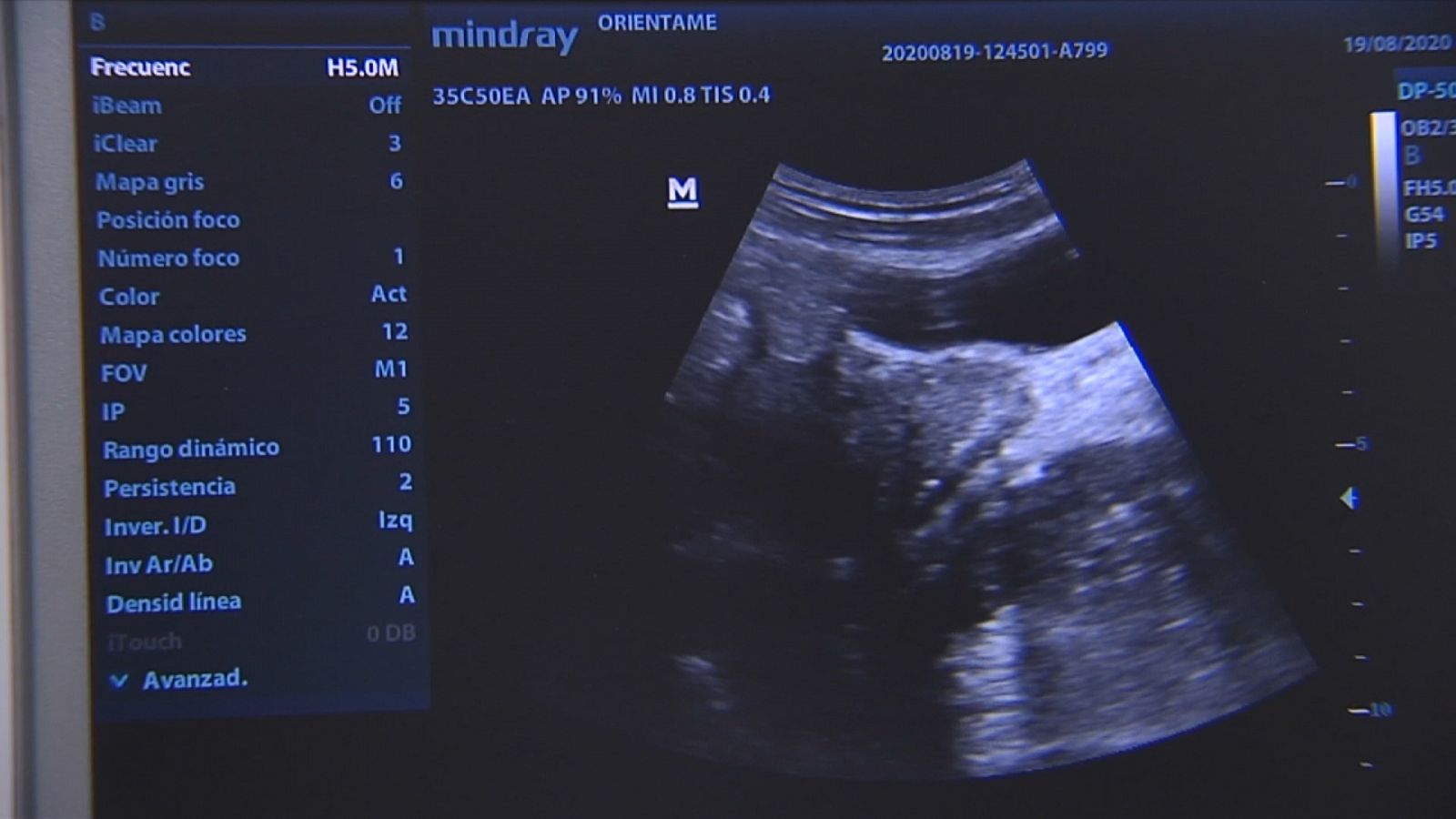 Polémica aborto - Ver ahora