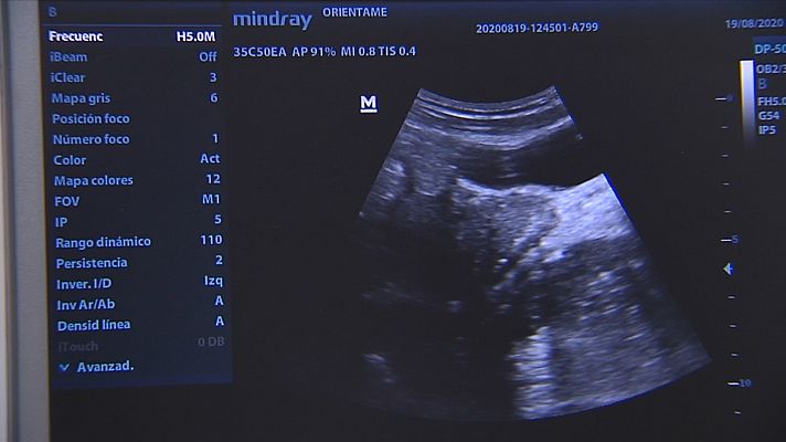 Polémica aborto