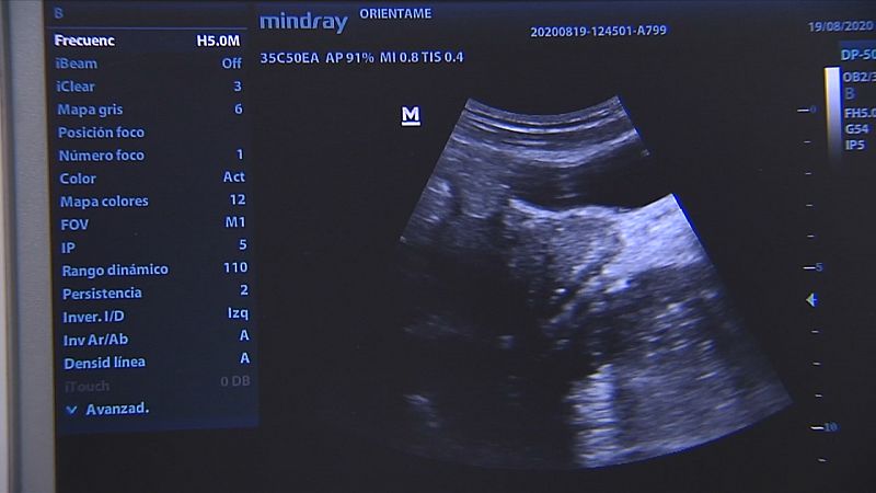 Polémica aborto - Ver ahora
