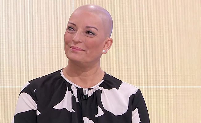 Hablando claro - Vivir con alopecia: "Es una sensación de vacío y soledad cuando te diagnostican la alopecia y no sabes qué hacer"
