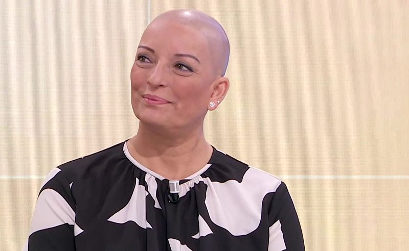 Vivir con alopecia: "Es una sensación de vacío y soledad cuando te diagnostican la alopecia y no sabes qué hacer"