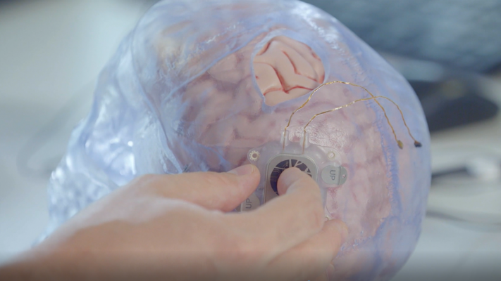 Un implante neuronal para ayudar a recuperar el habla