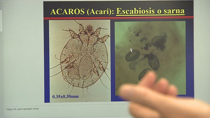 L'informatiu - Comunitat Valenciana - Recomendaciones y consejos ante los brotes de sarna