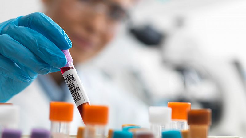 de Düsseldorf: tercer curado de VIH en el mundo tras trasplante de células madre