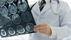 ¿Cómo prevenir los ictus cerebrales?