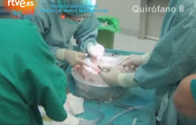 Ciencia y tecnología en Rtve.es - Innovadora técnica en pulmones