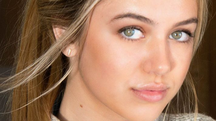 Telediario 1 - Cambiarse el color de ojos, una operación estética de alto riesgo