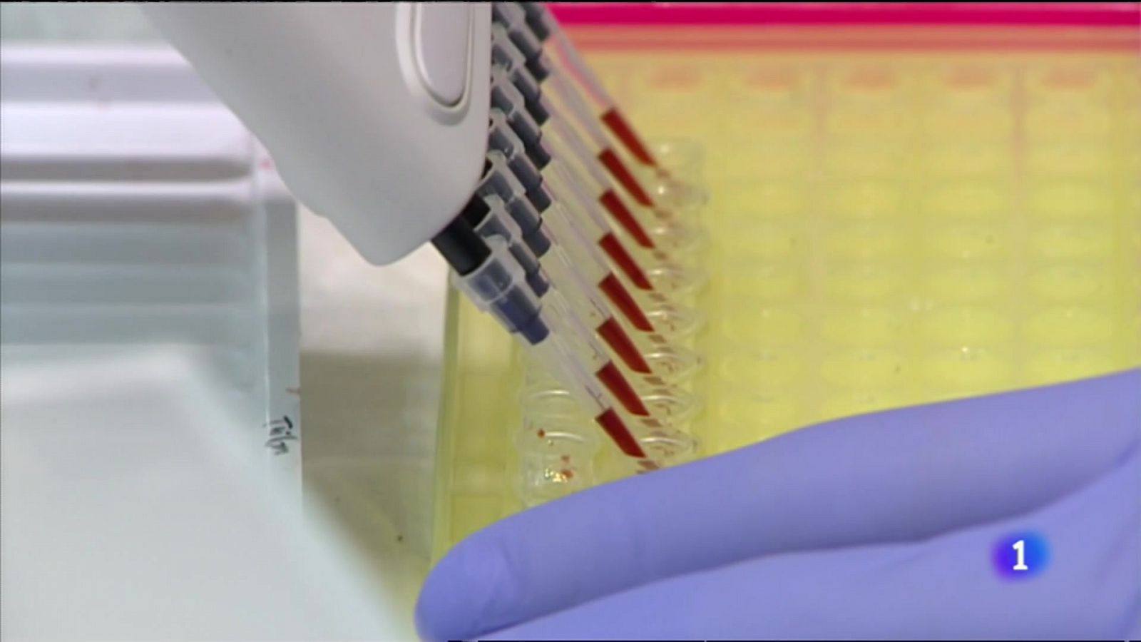 La detecció primerenca és clau per a superar un càncer de còlon