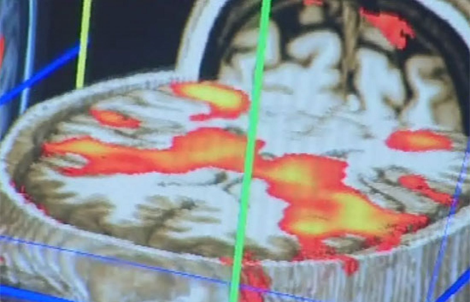 Una nueva tecnología de escáner cerebral detecta la parte del cerebro que activa su respuesta