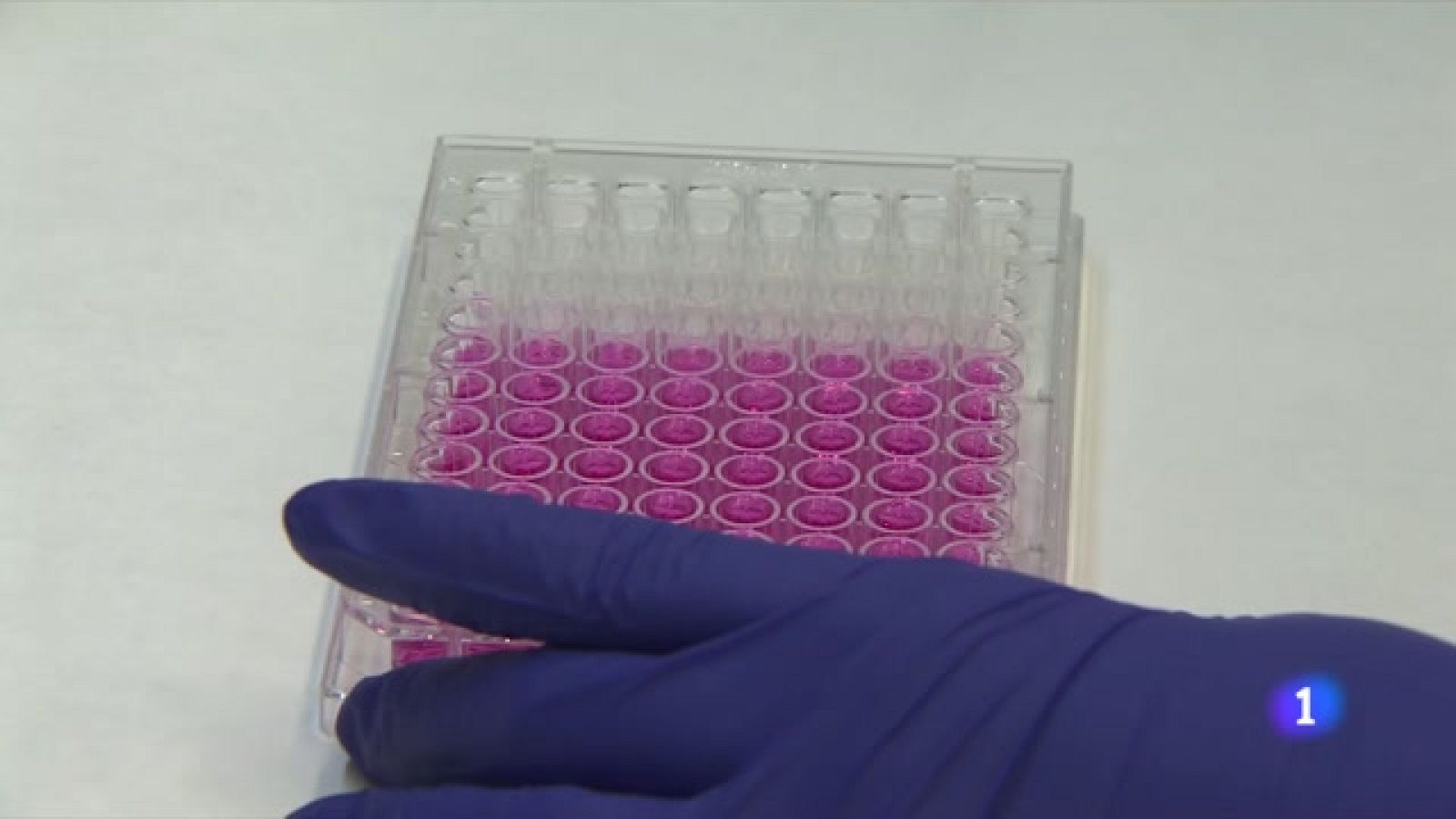 Per què alguns pacients de càncer de colon són resistents a la quimioteràpia?