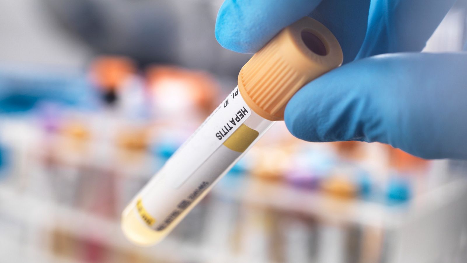 Repuntan las infecciones de transmisión sexual: causas y riesgos - Hablando claro | Ver