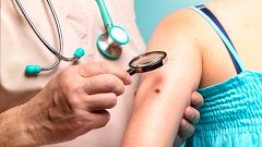 Buenos hábitos al sol como medida de protección ante los melanomas