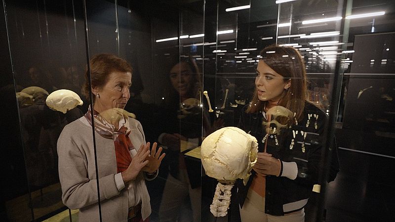 Miguelón: el cráneo mejor conservado del mundo 