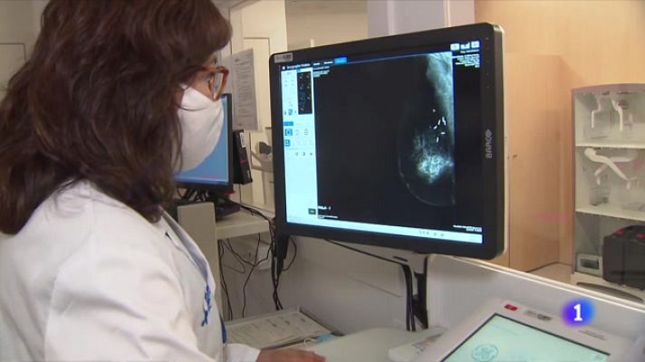 Telediario Fin de Semana - Curar el cáncer de mama sin quimioterapia