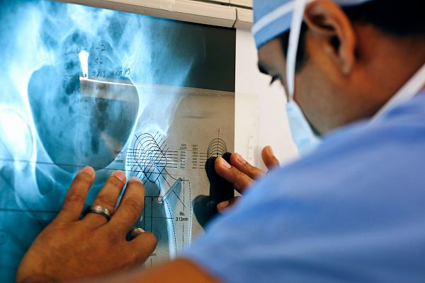 Hablando claro - Osteoporosis: qué es, a quién afecta y cómo prevenirla