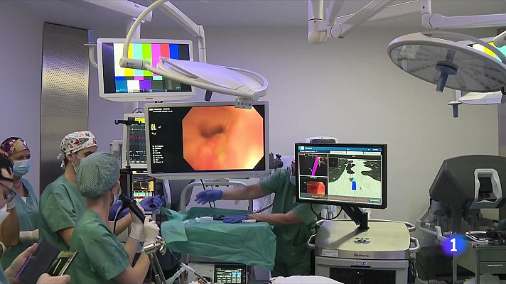 L'Informatiu - Tècnica pionera per delimitar els nòduls del càncer de pulmó