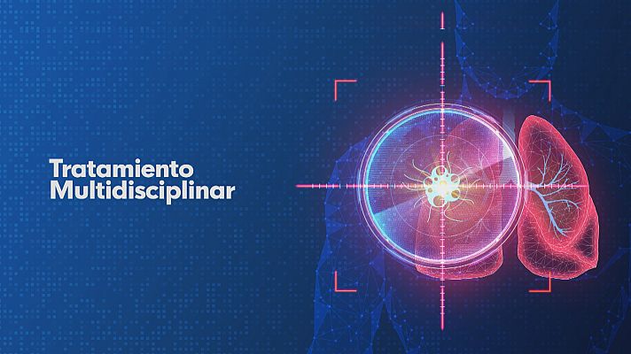 Noticias Andalucía - Cuidados para los pacientes con cáncer