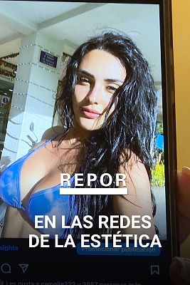 Repor - En las redes de la estética