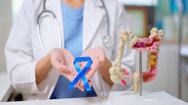 Cada vez hay más cáncer de colon en personas jóvenes