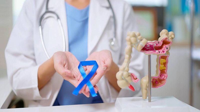 Cáncer de colon en personas jóvenes, ¿por qué sucede?