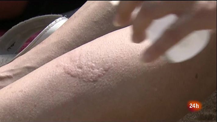 L'Informatiu - Aprendre a conviure amb les meduses