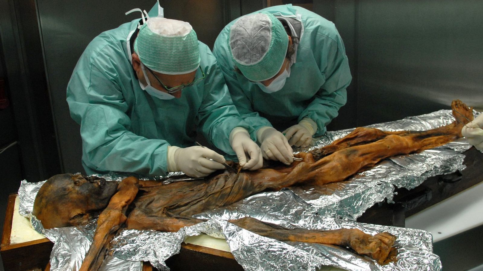Nuevos datos de Ötzi, el 'Hombre del Hielo': tenía la piel más oscura y era posiblemente calvo