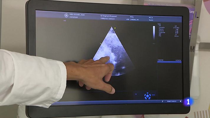 L'Informatiu - Nou implant de vàlvula al cor, a la Vall d'Hebron