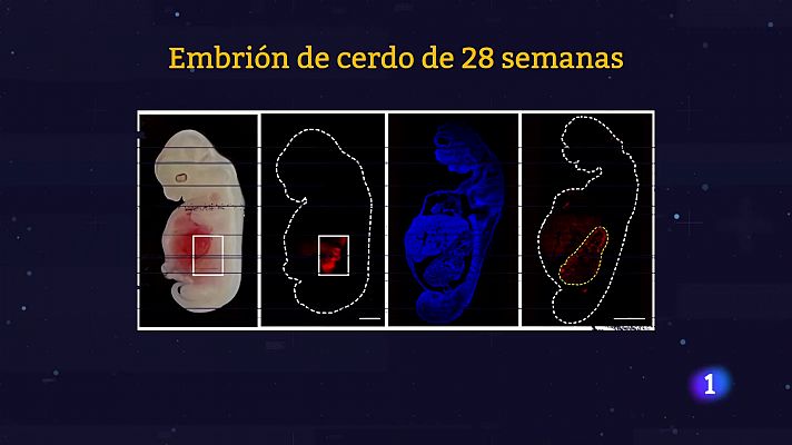 Científicos chinos desarrollan riñones con células humanas en embriones de cerdo