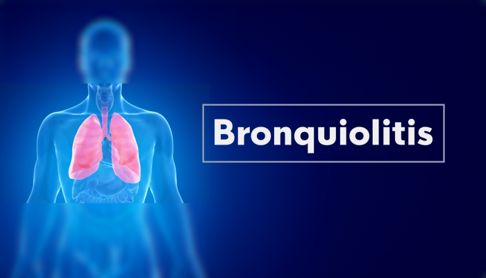 Dosis contra la bronquiolitis