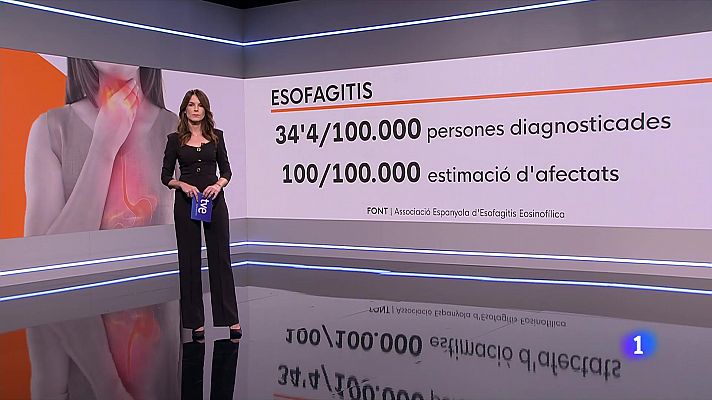 La vida complicada dels malalts d'esofagitis