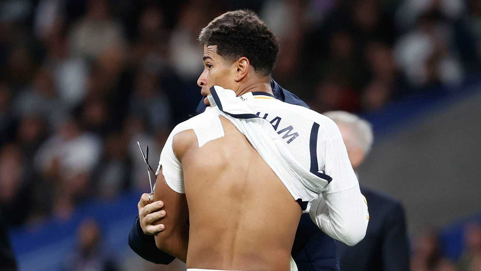 Lesión de Jude Bellingham: qué tiene, cuánto tiempo estará de baja | Ver