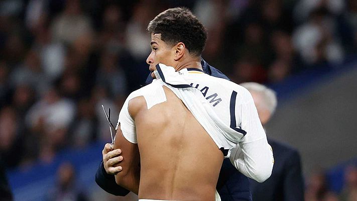 Telediario 1 - El Madrid no arriesgará con Bellingham tras confirmarse su luxación de hombro