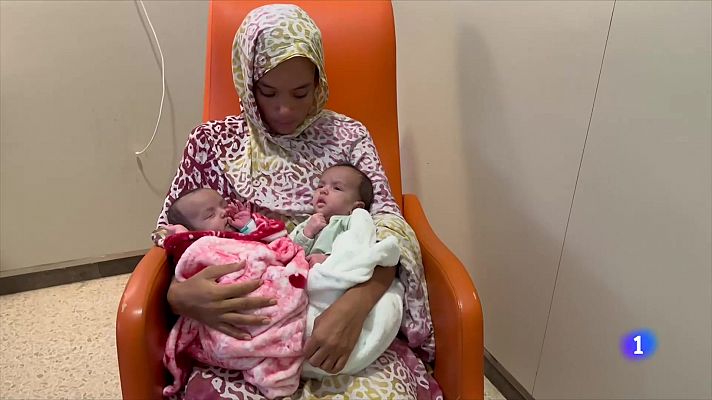 L'Informatiu - Separació amb èxit de les dues nadons siameses