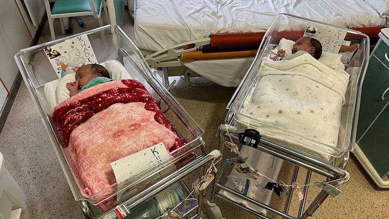 La simulación 3D permite separadas en Barcelona a dos bebés siamesas mauritanas unidas por el abdomen