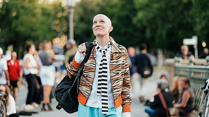 Objetivo igualdad - Programa 113: Alopecia femenina