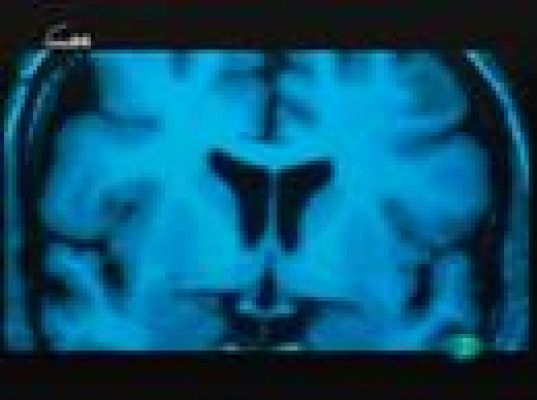 tres14 - En una gota de sangre