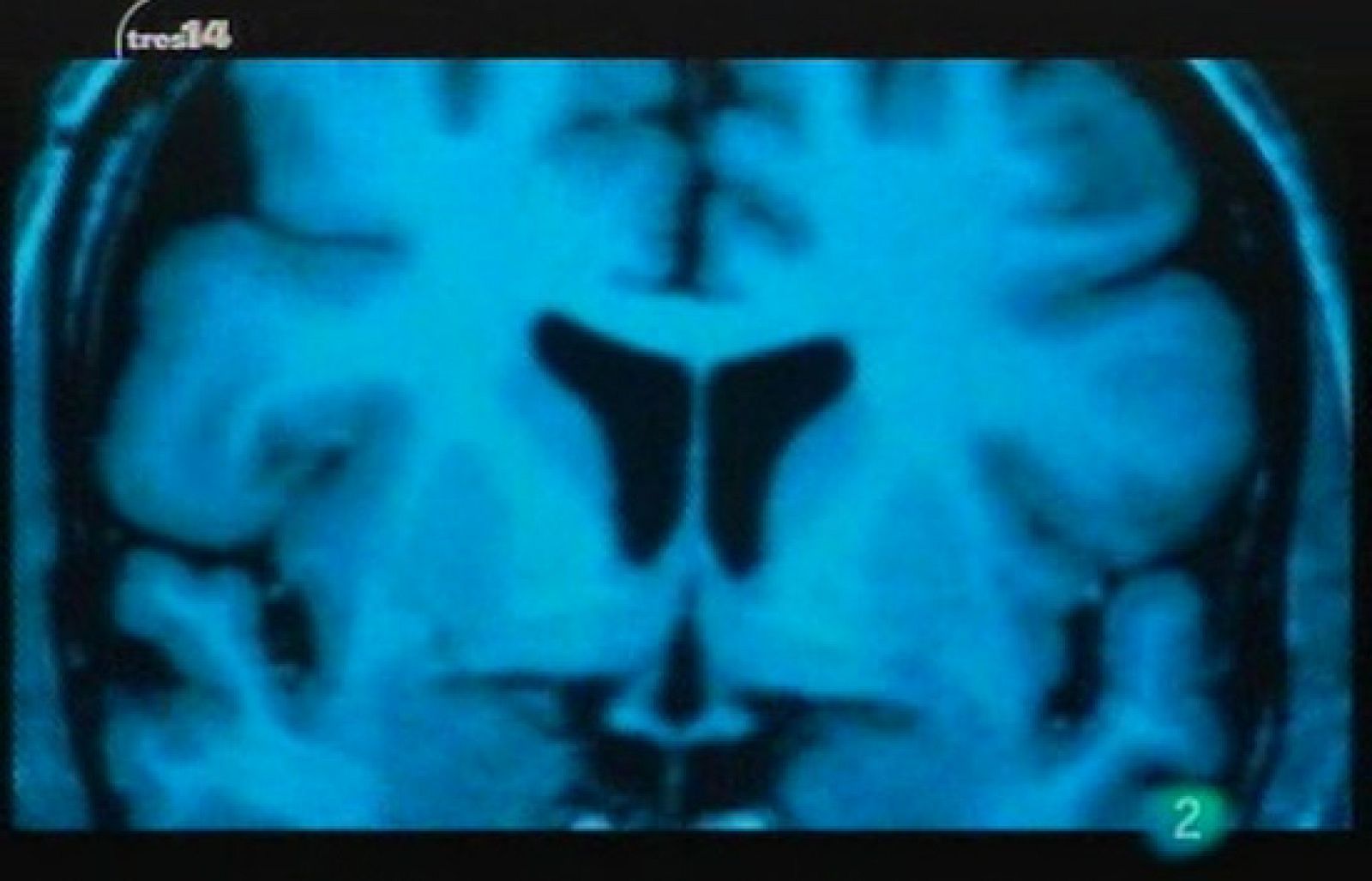 En una gota de sangre (sangre)