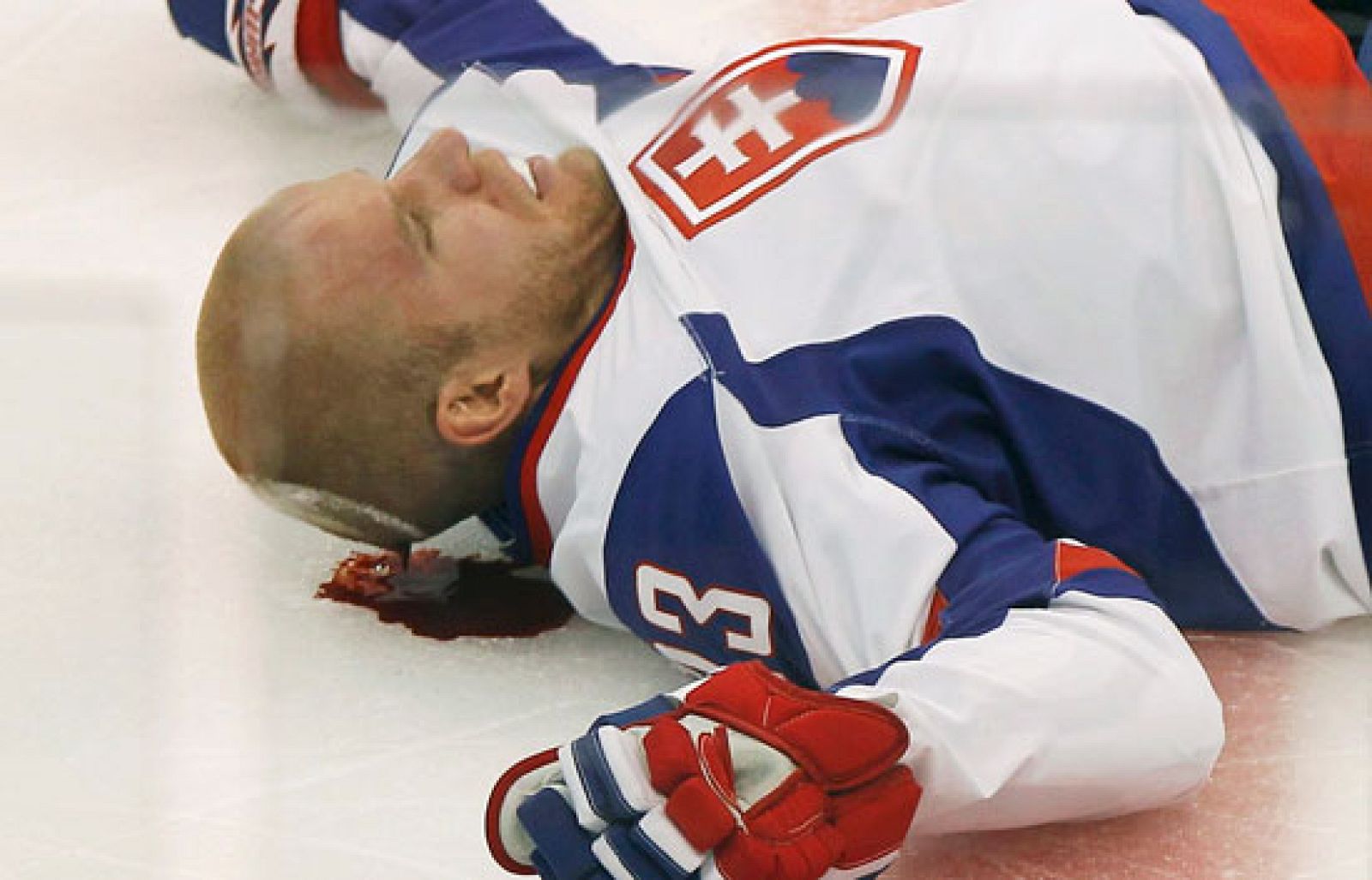 Sin programa: Bartecko, el susto de la jornada | RTVE Play