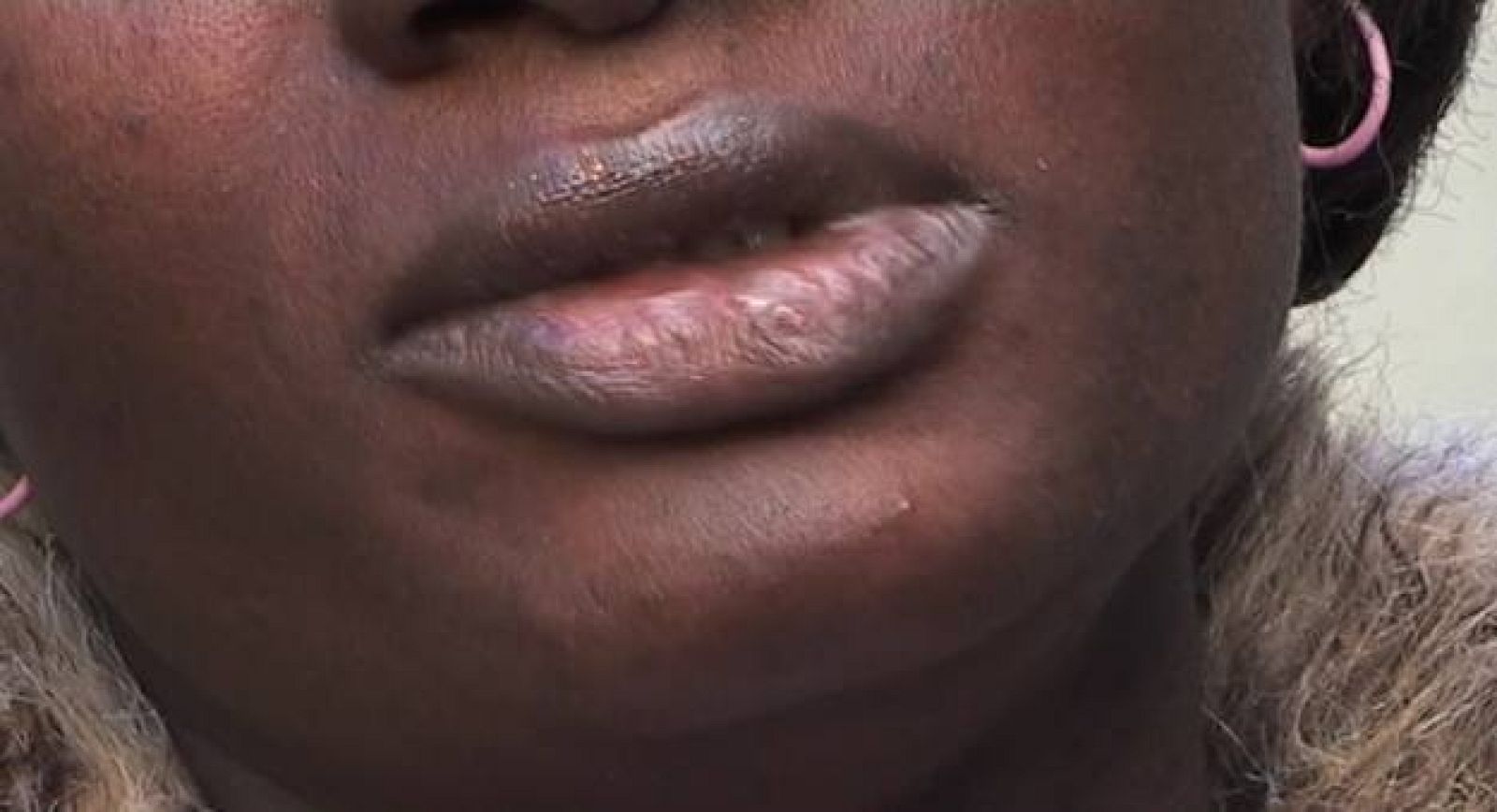 La violencia sexual contra las migrantes subsaharianas | Ver