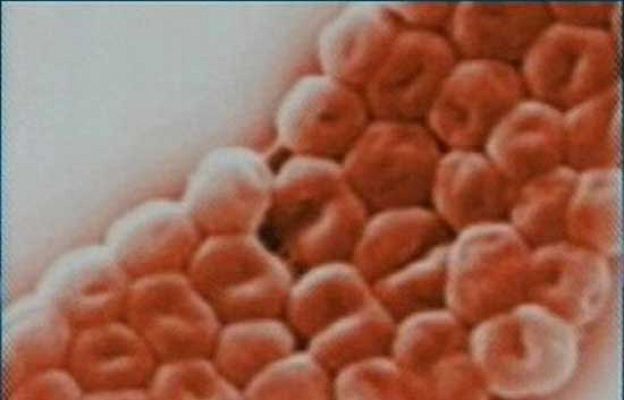 Ciencia y tecnología en Rtve.es - La bacteria del Doce de Octubre