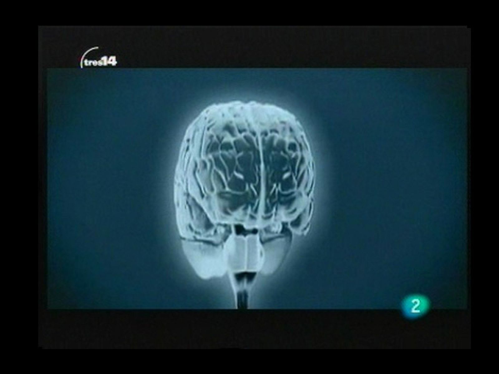 Falta de atención (atención)