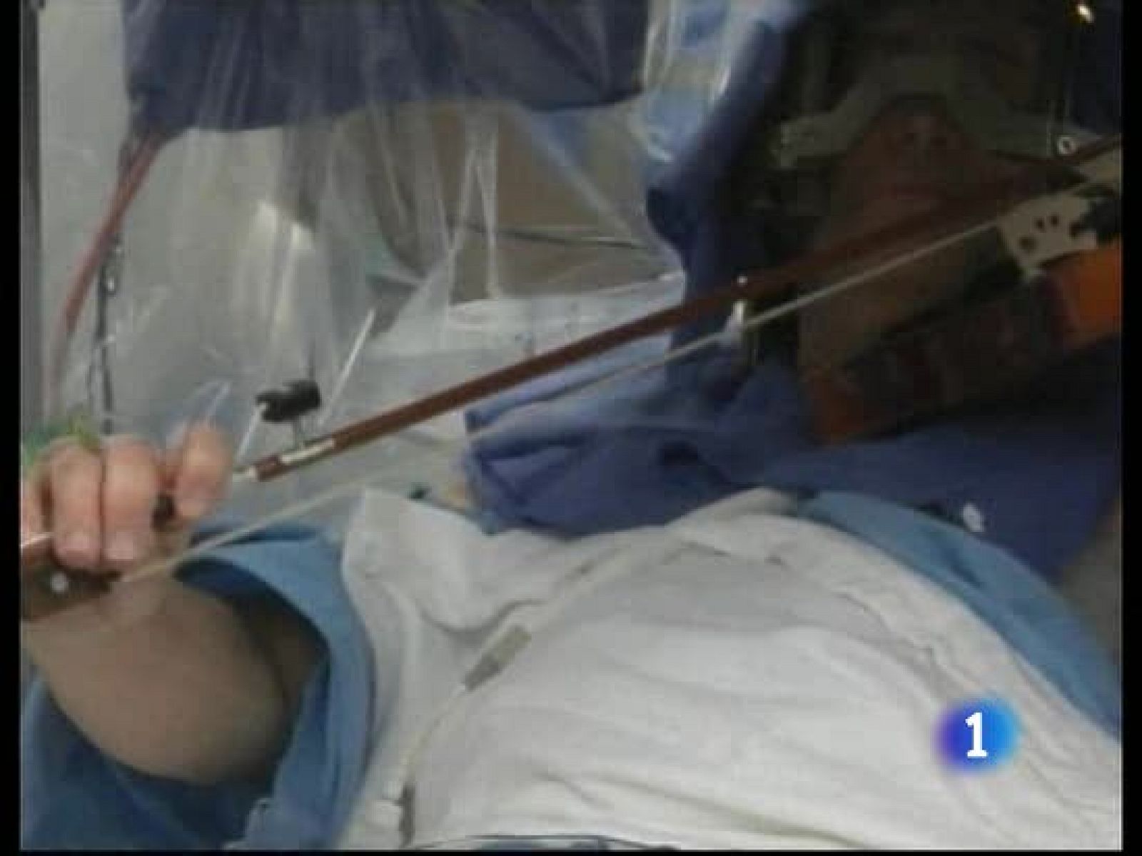 Cirujanos de Estados Unidos han conseguido eliminar el temblor de la mano de un violinista estimulando su cerebro - Ciencia y tecnología en Rtve.es | Ver