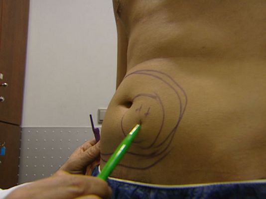 Ciencia y tecnología en Rtve.es - Aumentan los jóvenes que se operan