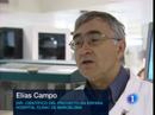  - Avances en la lucha contra leucemia