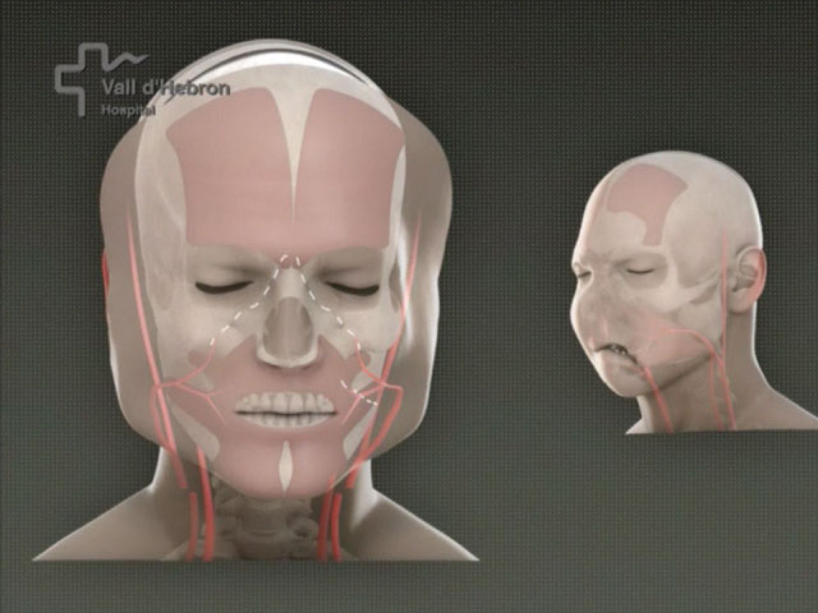 Ha sido un éxito total el primer trasplante que se hace en el mundo del rostro completo