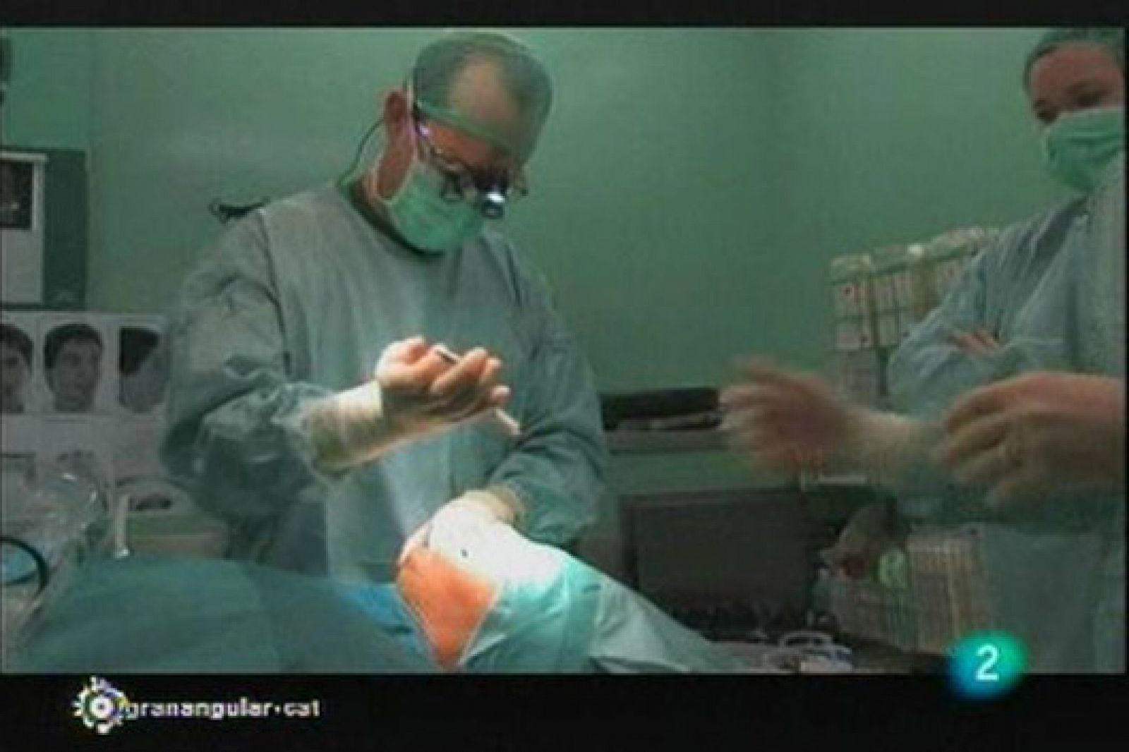 Granangular.cat: El rostre del cirurgià | RTVE Play